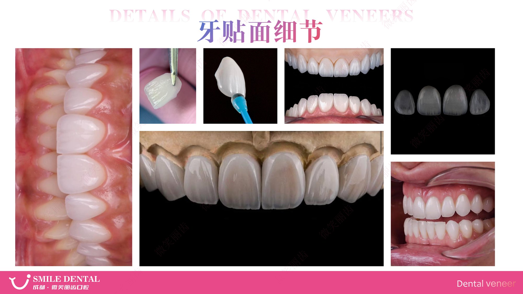 Smile Dental Aesthetic Clinic translated English material and case image 002