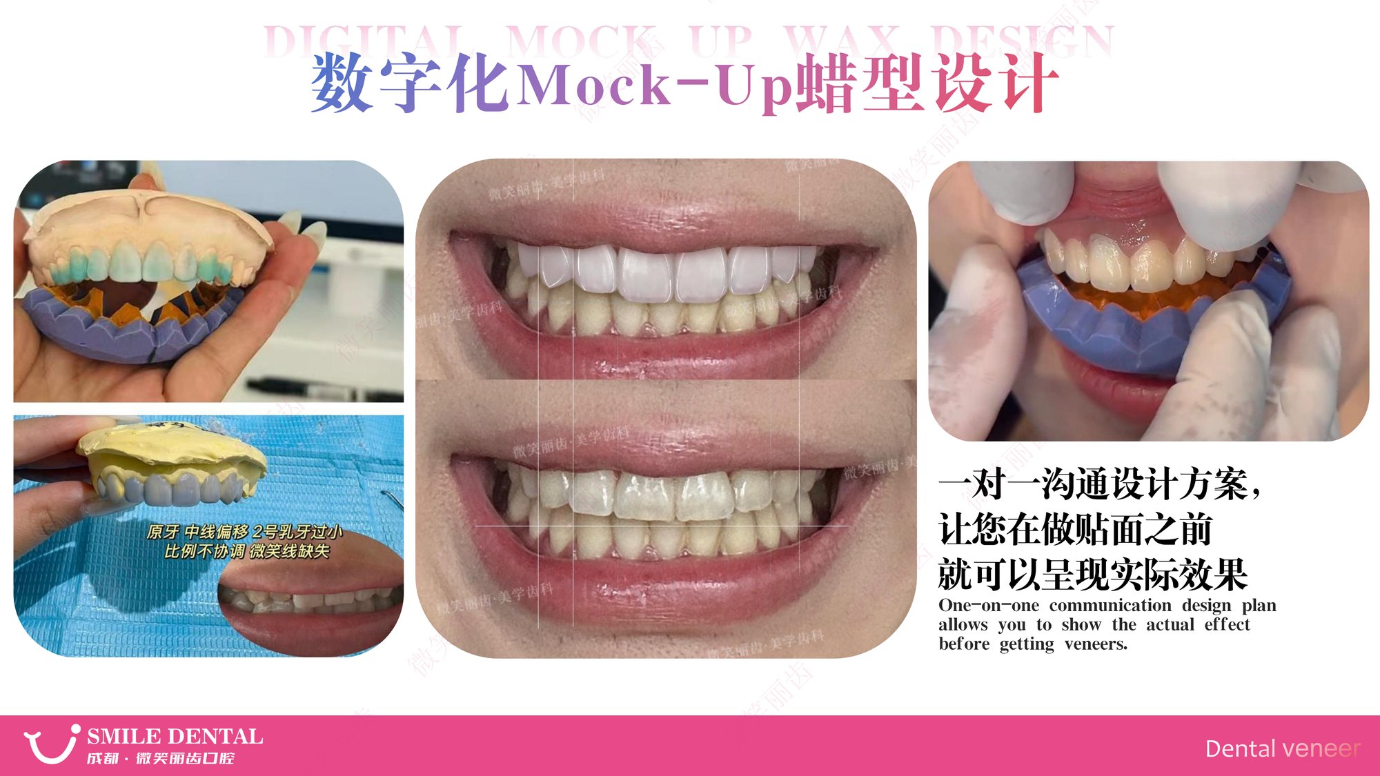 Smile Dental Aesthetic Clinic translated English material and case image 003