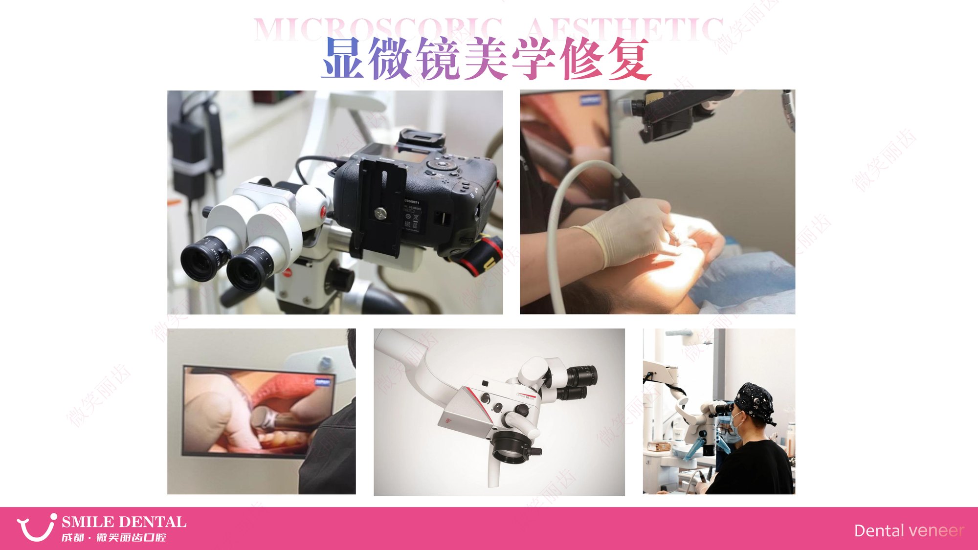 Smile Dental Aesthetic Clinic translated English material and case image 004
