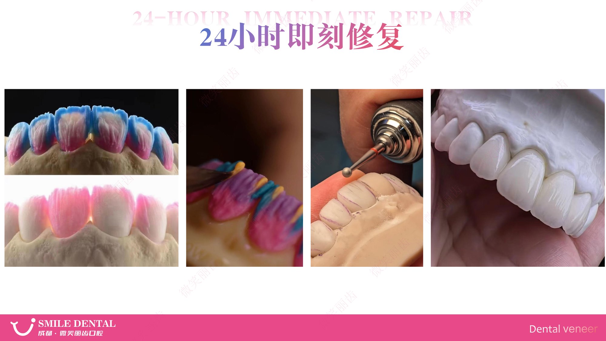 Smile Dental Aesthetic Clinic translated English material and case image 005