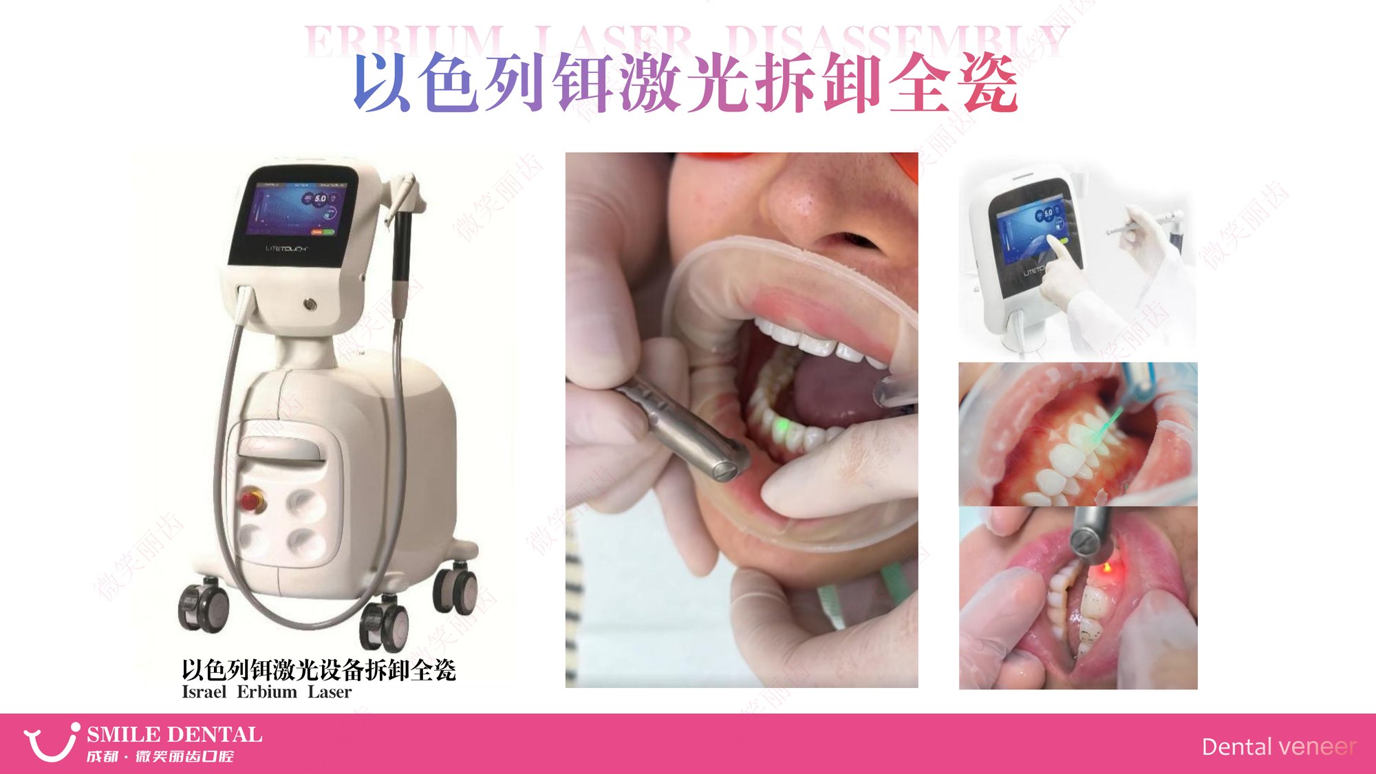 Smile Dental Aesthetic Clinic translated English material and case image 006