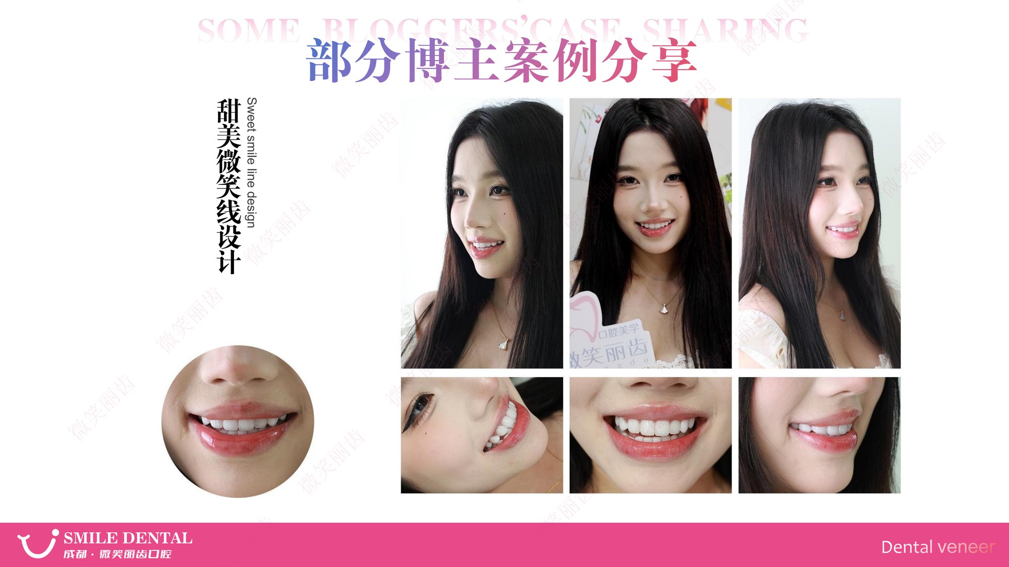 Smile Dental Aesthetic Clinic translated English material and case image 009
