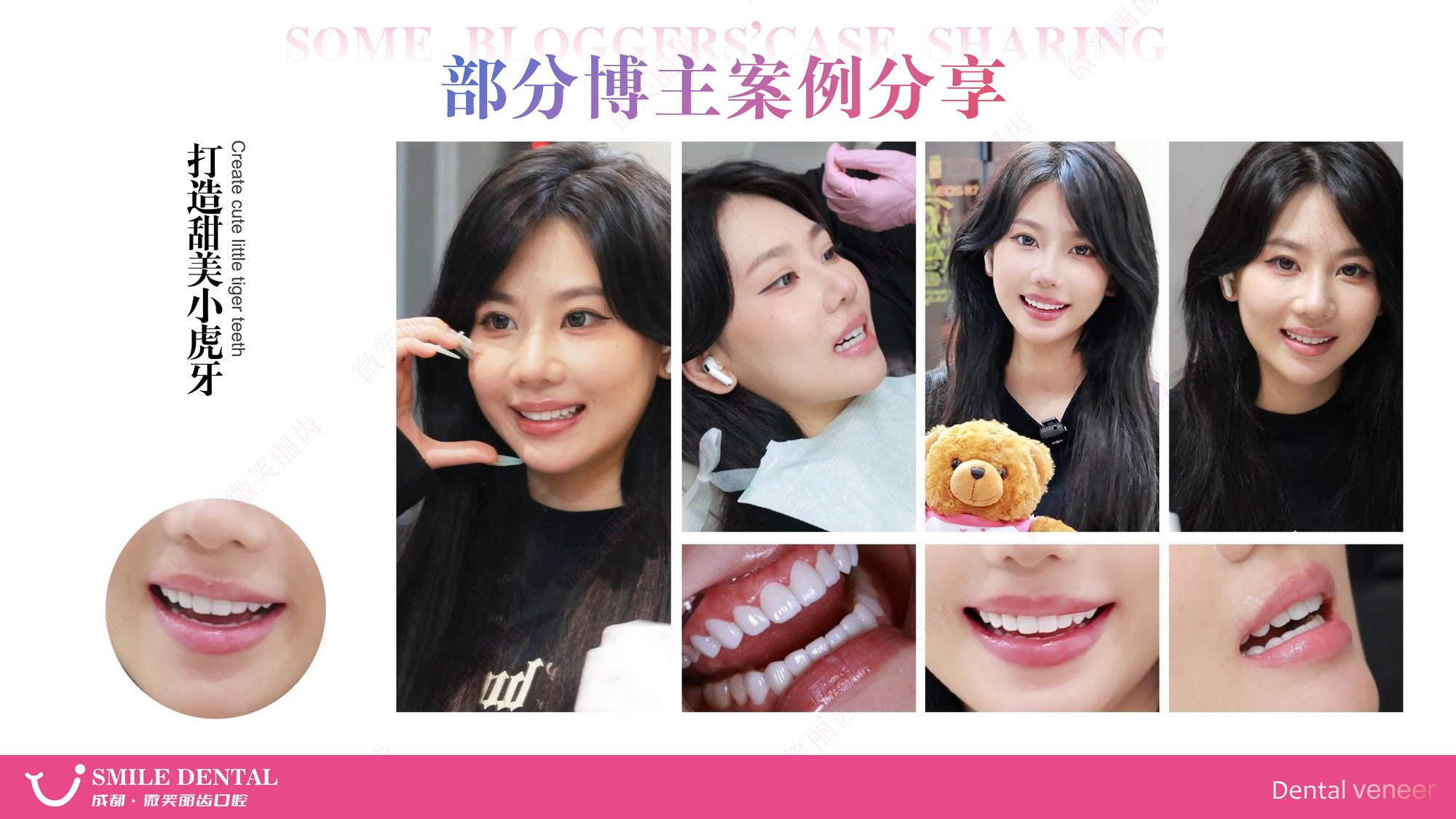 Smile Dental Aesthetic Clinic translated English material and case image 010