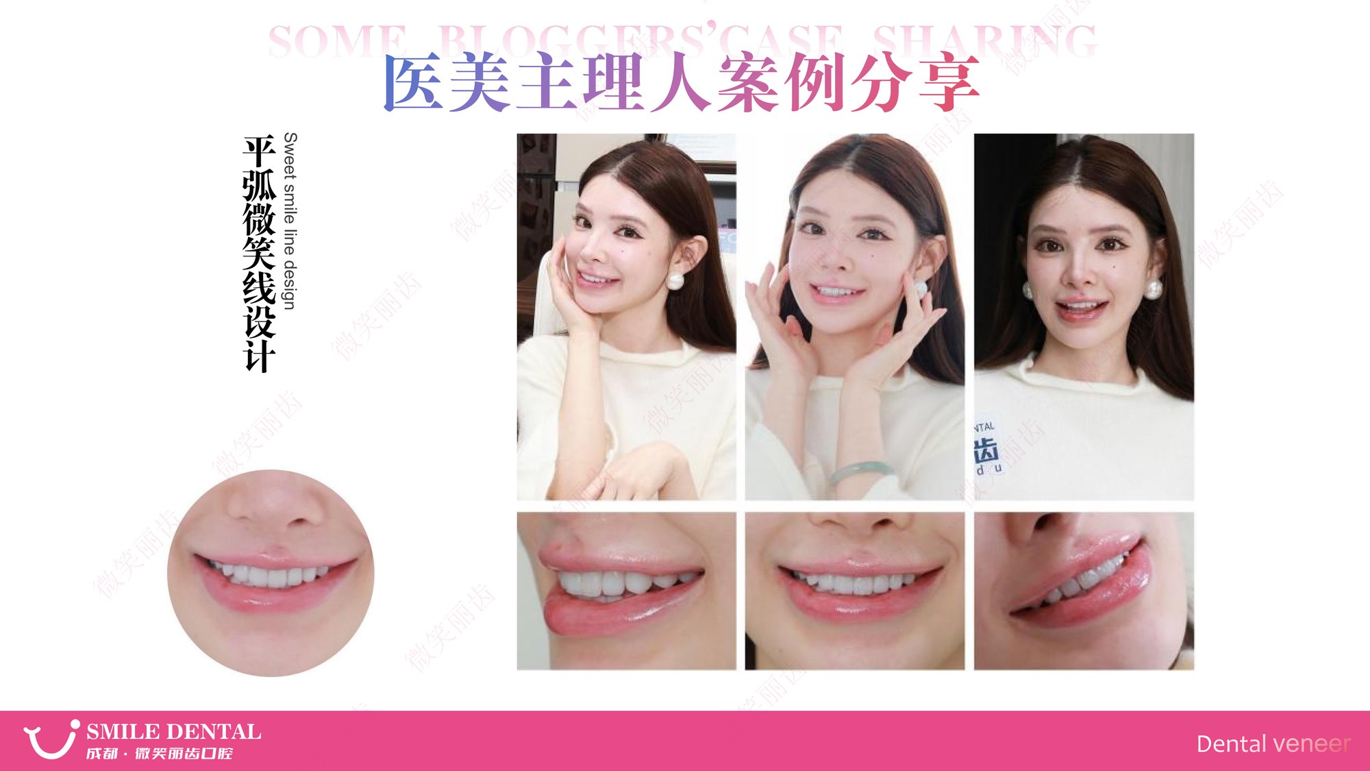 Smile Dental Aesthetic Clinic translated English material and case image 011
