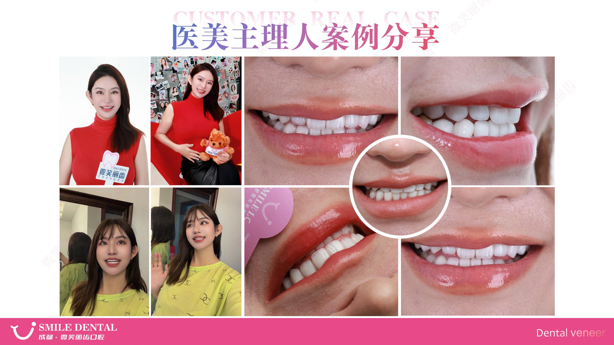 Smile Dental Aesthetic Clinic translated English material and case image 012