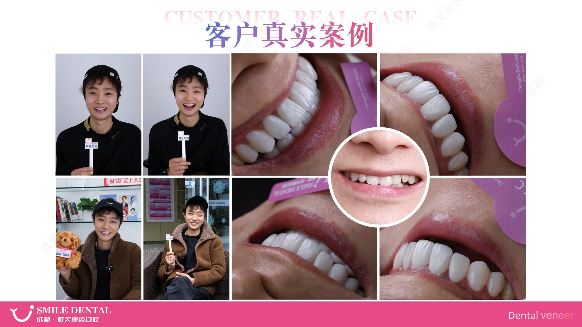 Smile Dental Aesthetic Clinic translated English material and case image 013