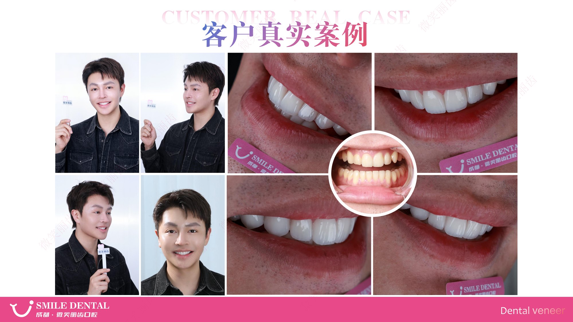 Smile Dental Aesthetic Clinic translated English material and case image 016