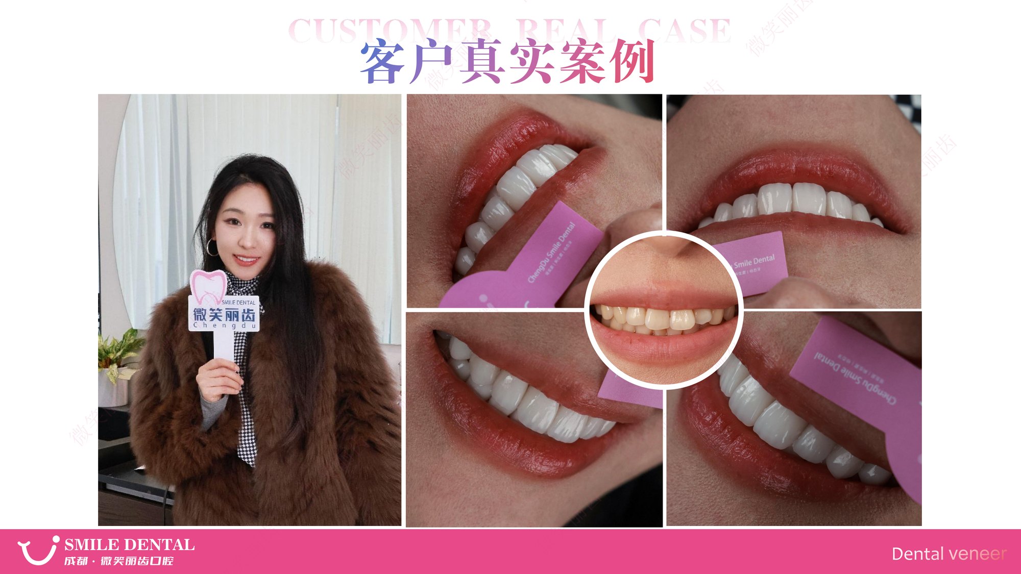 Smile Dental Aesthetic Clinic translated English material and case image 017