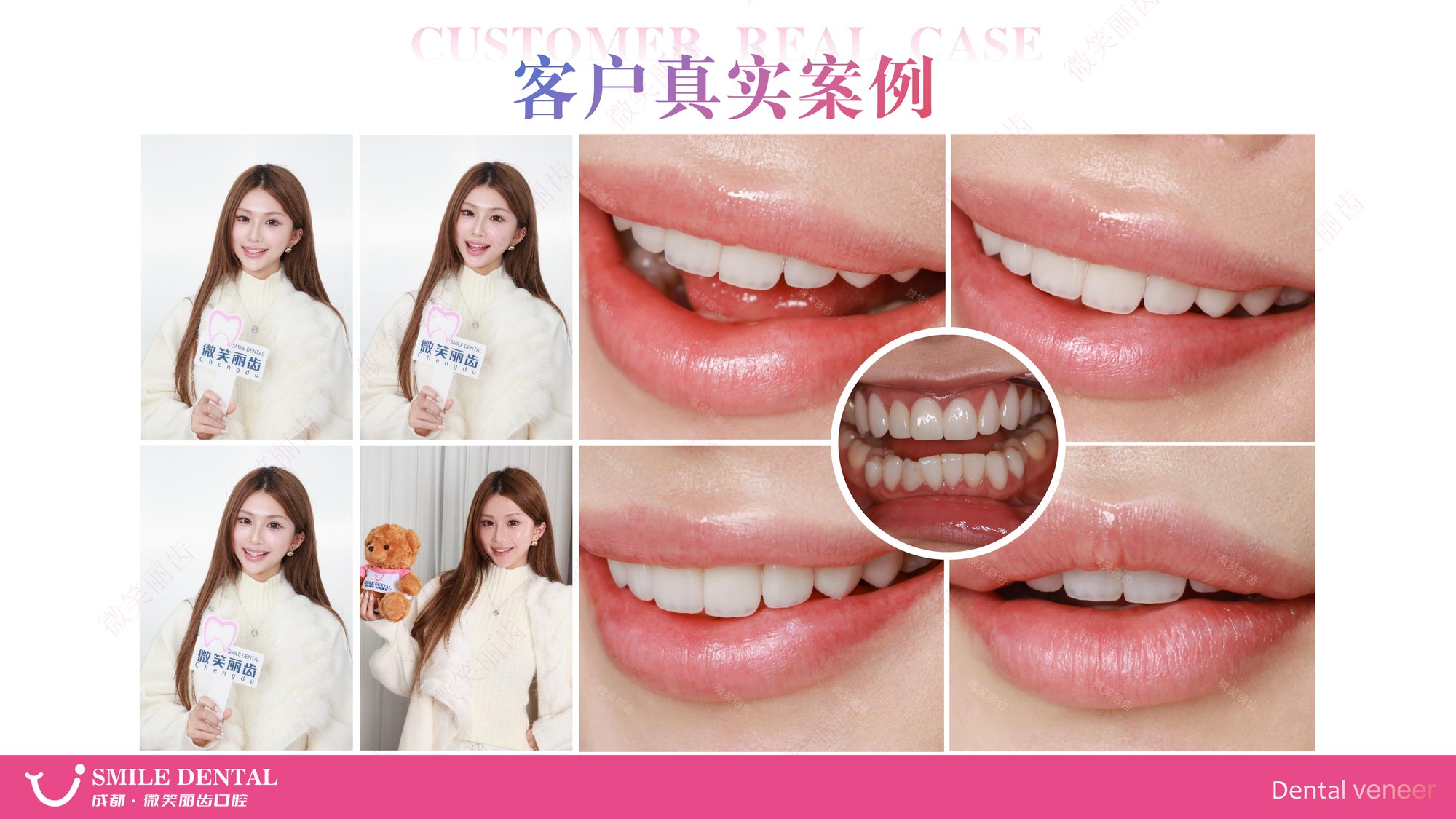 Smile Dental Aesthetic Clinic translated English material and case image 018