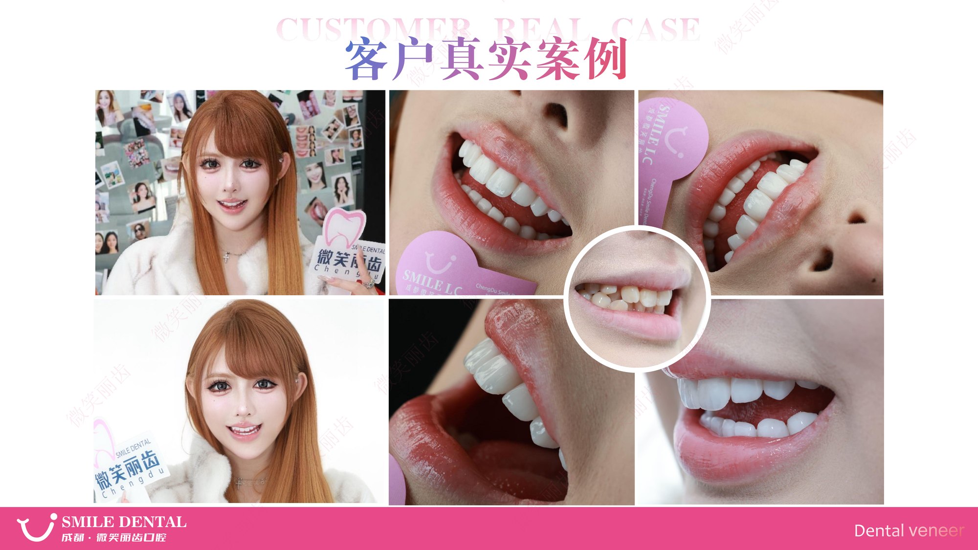 Smile Dental Aesthetic Clinic translated English material and case image 019