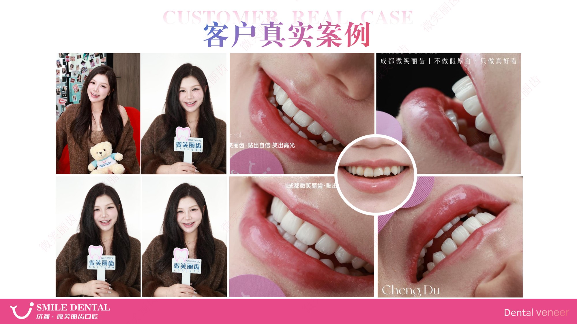 Smile Dental Aesthetic Clinic translated English material and case image 020