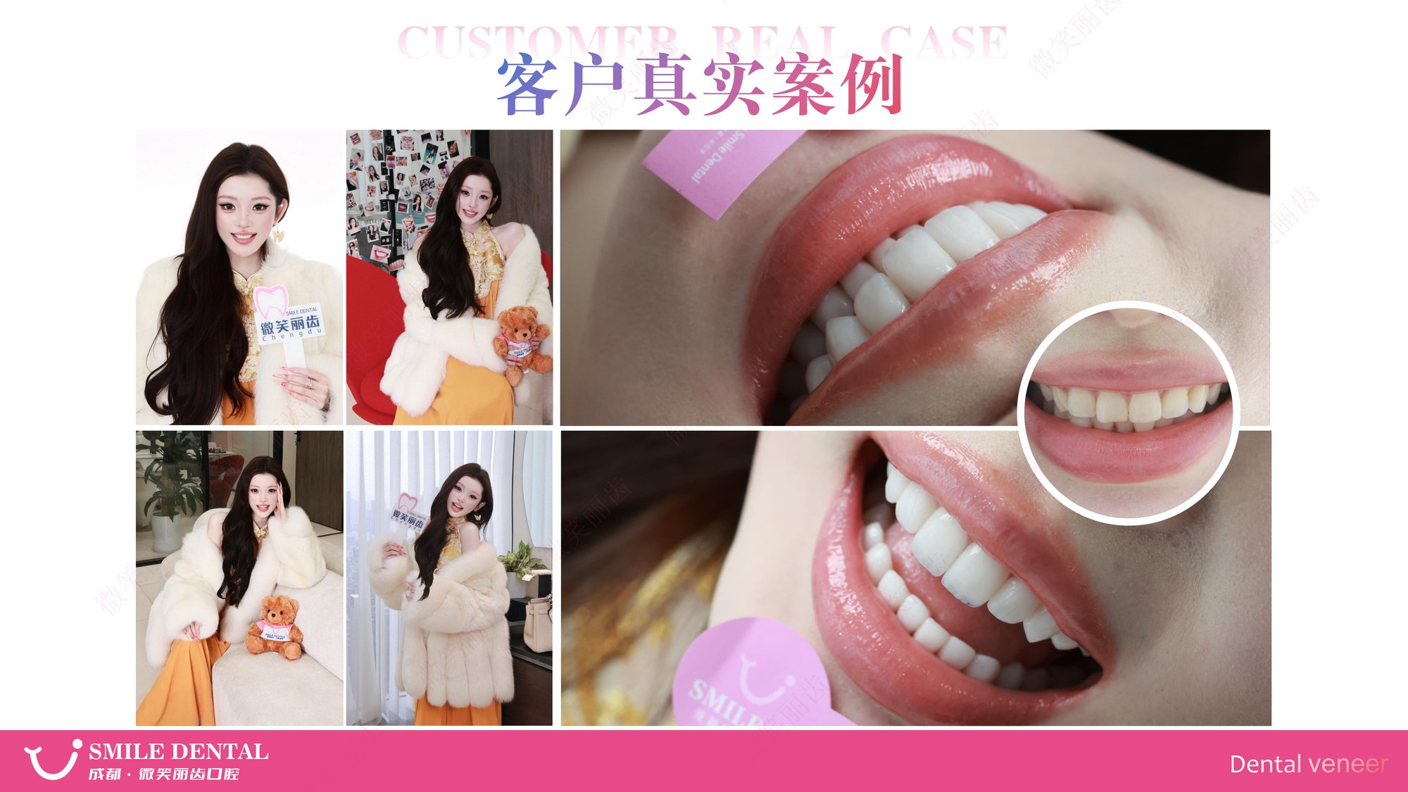 Smile Dental Aesthetic Clinic translated English material and case image 021