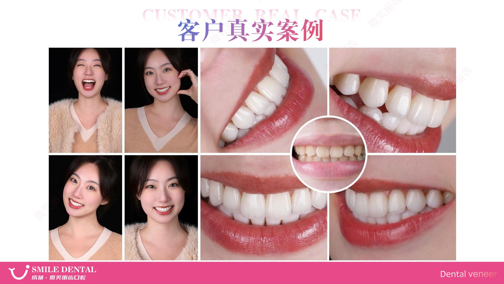 Smile Dental Aesthetic Clinic translated English material and case image 024