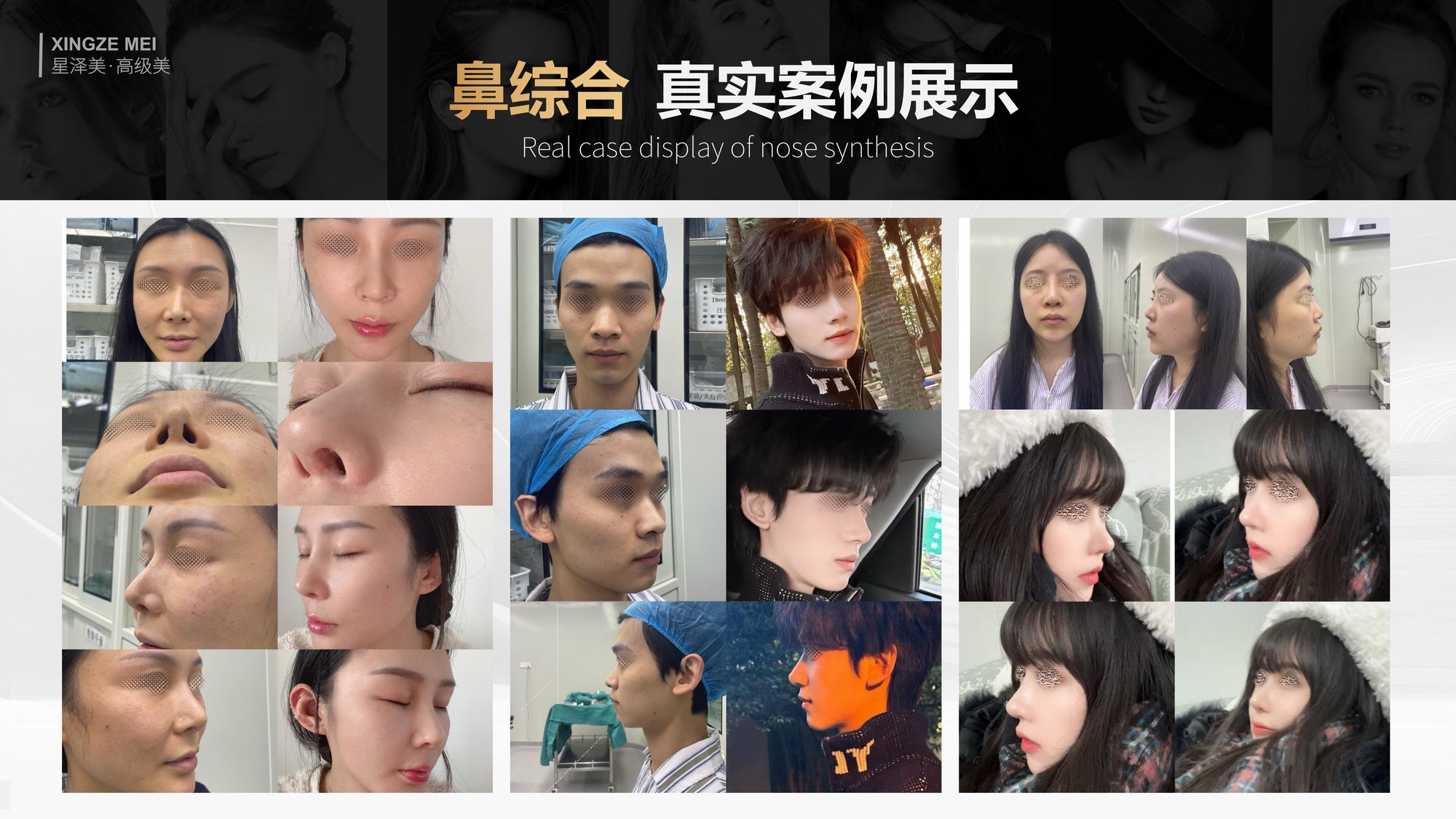 Xingze Medical Aesthetics translated English material and case image 019