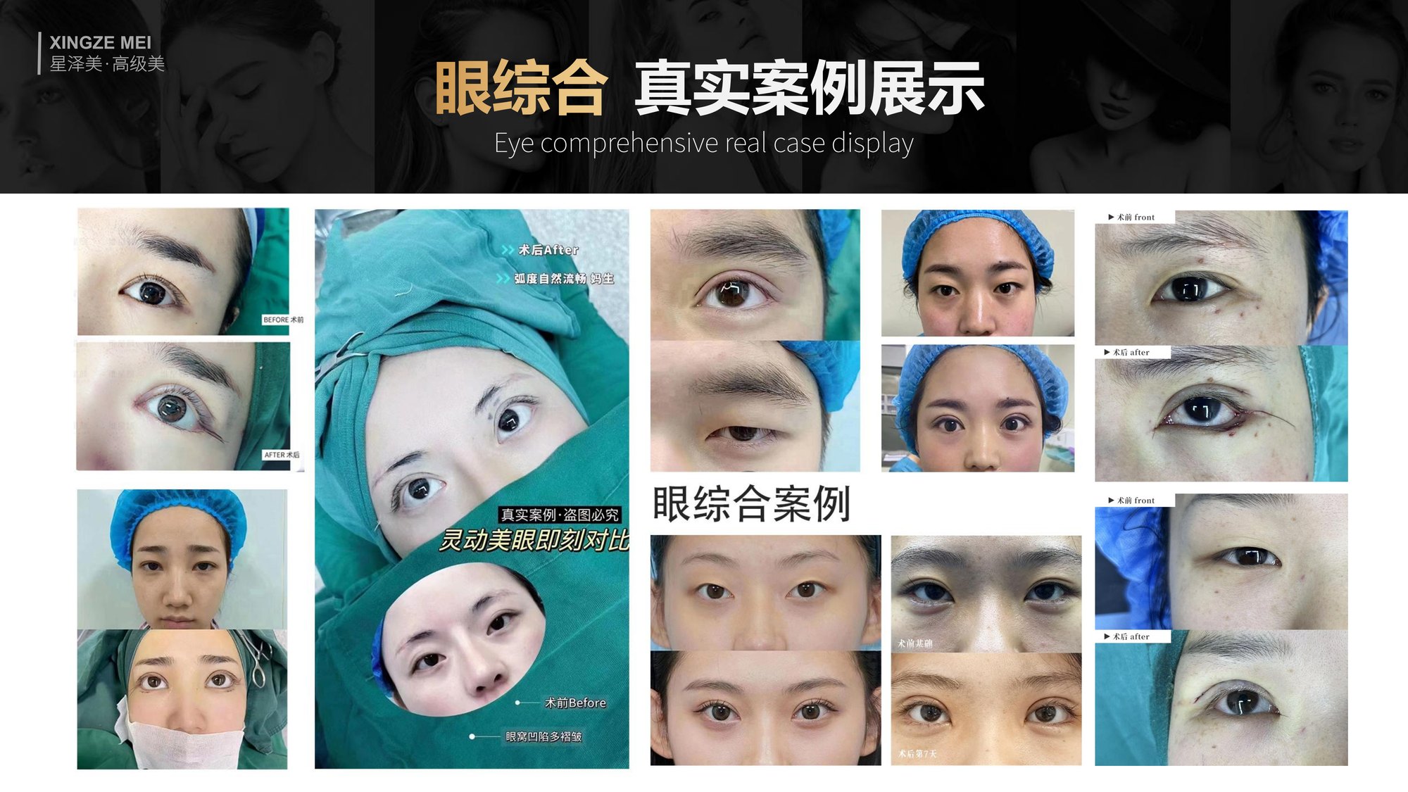 Xingze Medical Aesthetics translated English material and case image 021