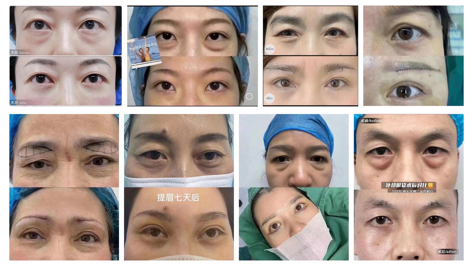 Xingze Medical Aesthetics translated English material and case image 022